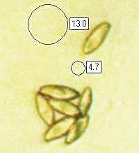 Spores of Boletus reticulatus