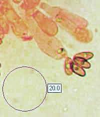 Basidia with spores - Chalciporus piperatus