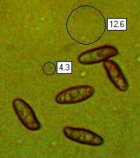 Spores of Xerocomellus cisalpinus