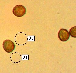 Spores of Cortinarius rubellus