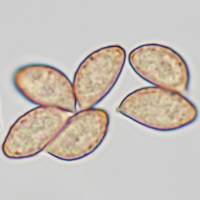 Spores of <em>Cortinarius triumphans</em>
