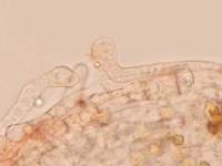 Pileipellis of <em>Crepidotus applanatus</em>