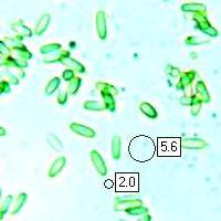 Spores of Clathrus ruber