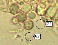 Spores of Russula fragilis