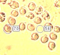 Spores of Tricholoma virgatum
