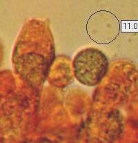 Spore and basidium of Amanita vaginata
