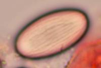 Spore of Cheilymenia granulata