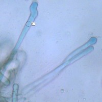 Paraphyses of Helvella elastica