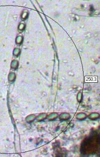 Asci of Brittle Cinder fungus