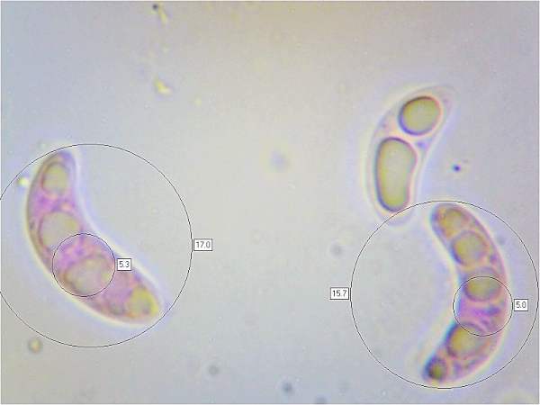 Spores of Aleuria aurantia