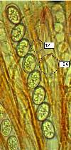 Asci and spores of the Eyelash Fungus, Scutellaria scutellata