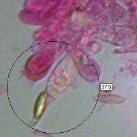 Cystidia of Leccinum versipelle