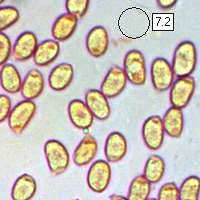 Spores of Cantharellu cibarius