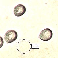 Spores of Cantharellus tubaeformis