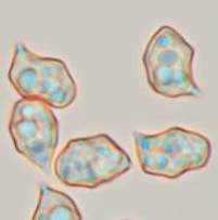 Spores of Entoloma caeruleum