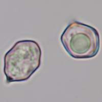 Spores of Entoloma sericeum