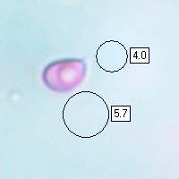 Spores of Fistulina hepatica