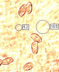 Spores of Ramaria formosa