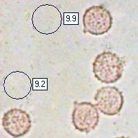 Spores of Laccaria tortilis