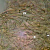 Pileipellis of Cuphophyllus pratensis - Meadow Waxcap