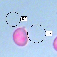 Hygrocybe citrinovirens spores
