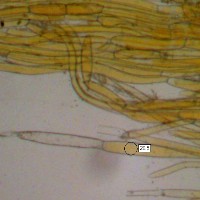 Spore of Hygrocybe intermedia