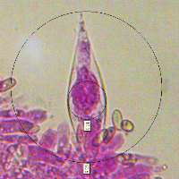 Cheilocystidia of Macrocystidia cucumis