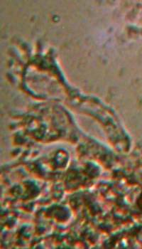 Cheilocystidia of <em>Mycena inclinata</em>