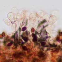 Cheilocystidia of <em>Lacrymaria lacrymabunda</em>