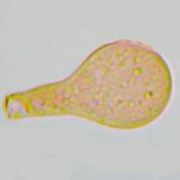 Small cheilocystidium of Psathyrella bipellis