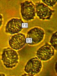 Spores of Lactarius aurantiacus