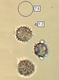 Spores of Lactarius fulvissimus