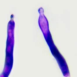 Pileipellis of Russula ionochlora