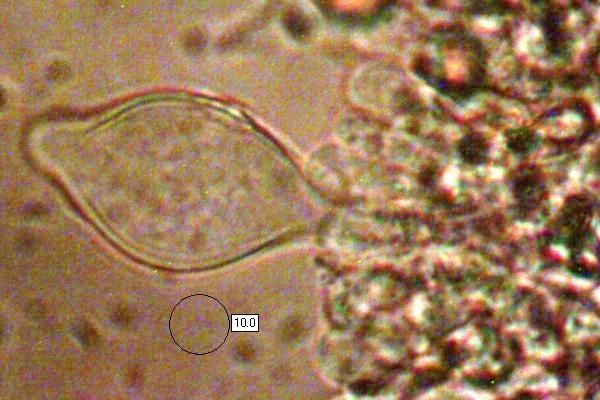 Cheilocystidia of <em>Cyclocybe cylindracea</em>