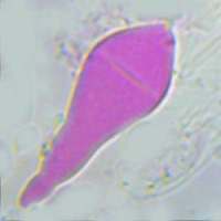 Cheilocystidium of Pholiota lubrica