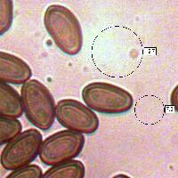 Spores of <em>Stropharia rugosoannulata</em>