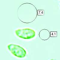 Spores of Clitocybe nebularis